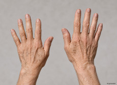 Altersflecken mit 40? So l�sst sich fr�hzeitig vorbeugen