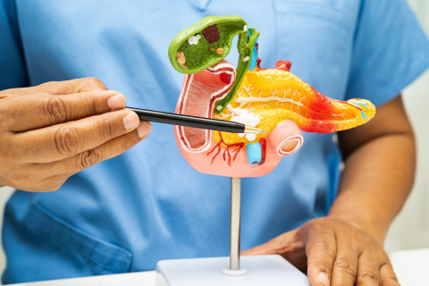 Neues Pankreas-Netzwerk Rhein-Ahr stärkt regionale Gesundheitsversorgung