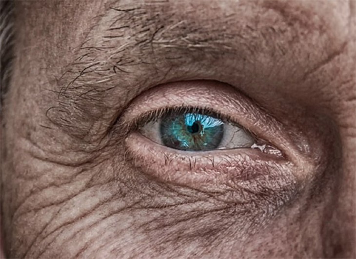 Falten unter den Augen entfernen: So kann man die Augenpartie
