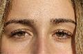 Augenringe abdecken ohne Make-Up mit diesen 5 Tipps