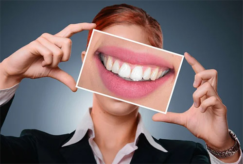 Attraktive Zhne dank der Anwendung einer Zahnschiene