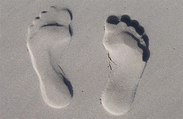 So wird Nagelpilz richtig behandelt